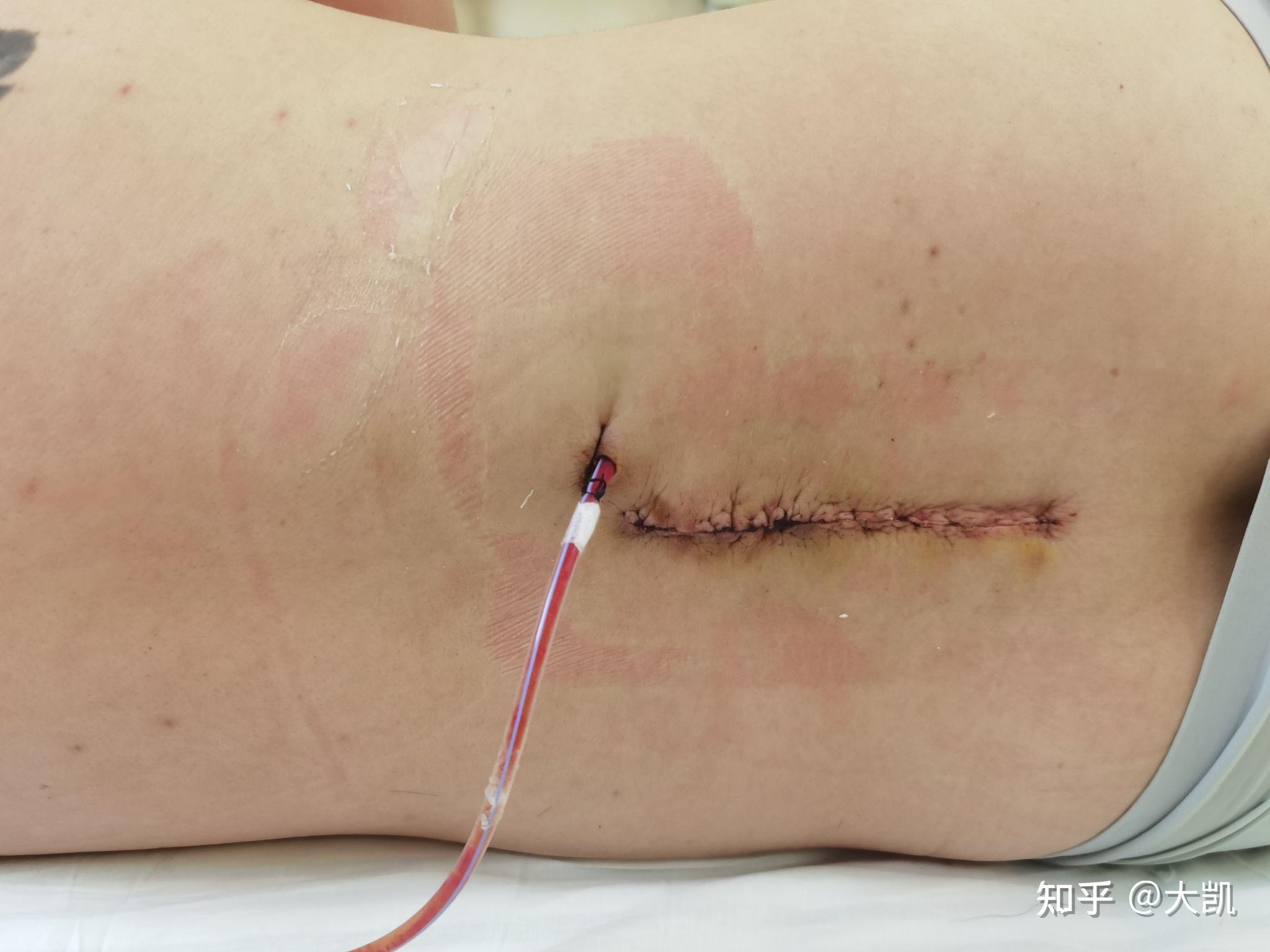 病人可以吃海參嗎_病人能吃海參粥嗎_病人吃海參功效與作用及禁忌
