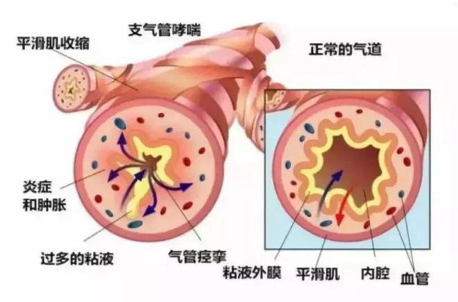 巴西龜肺炎泡什么藥_巴西龜肺炎治療_巴西龜肺炎怎么治