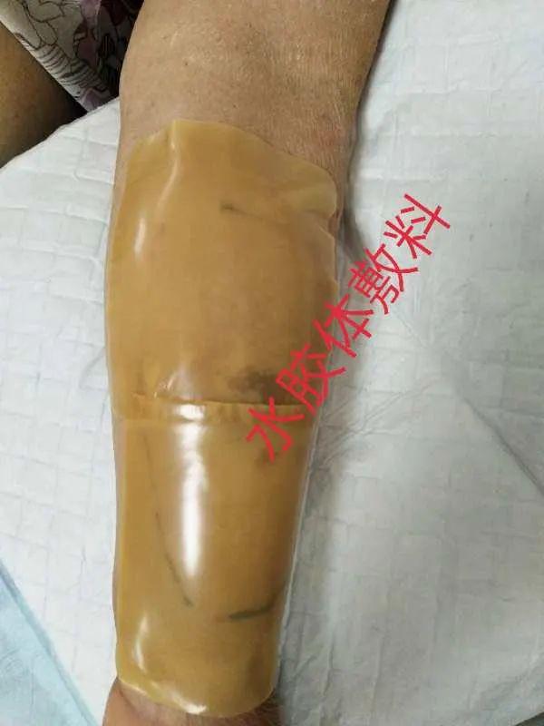 缺氧的魚怎么救_讓魚缺氧的藥_缺氧魚