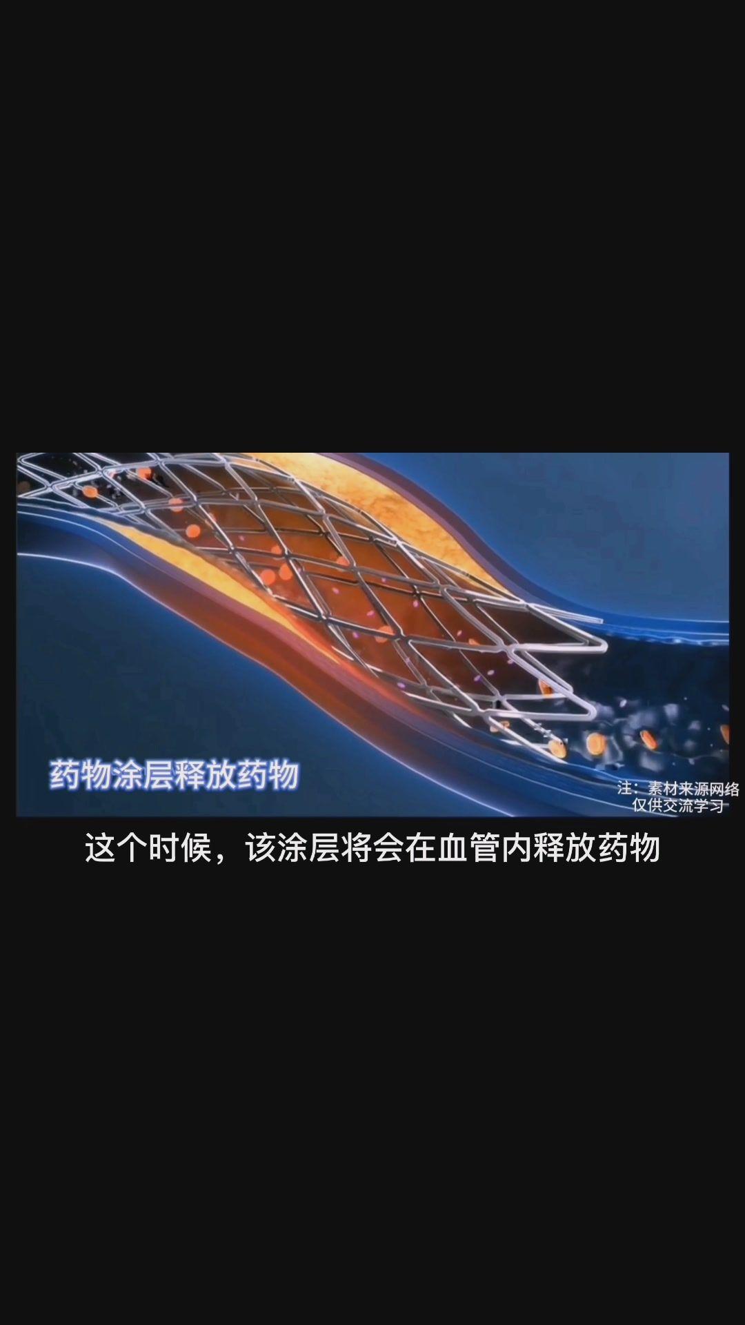 章魚的血_章魚的血_章魚的血