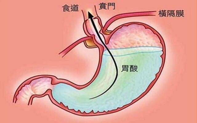鯨魚胃_鯨魚有幾個胃_鯨魚的胃液
