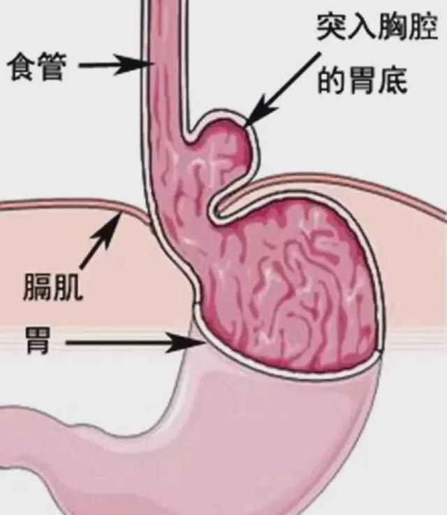 鯨魚胃_鯨魚有幾個胃_鯨魚的胃液
