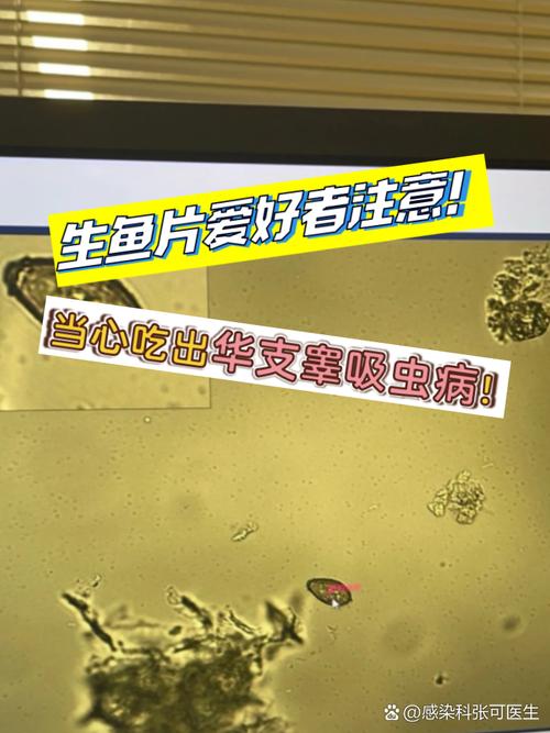 肛門寄生蟲癥狀_生魚片寄生蟲感染_魚生寄生蟲